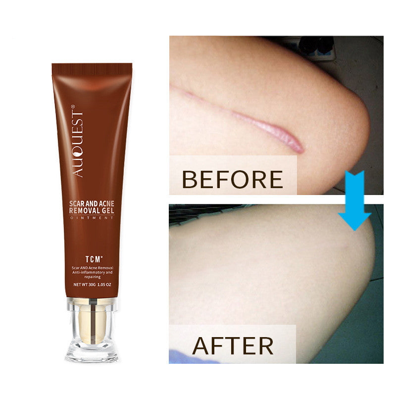 Repairing Scar Skin Care Cream